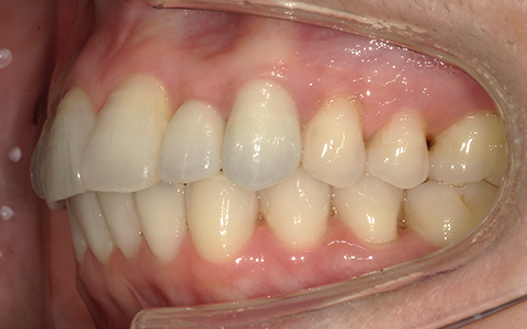 After image