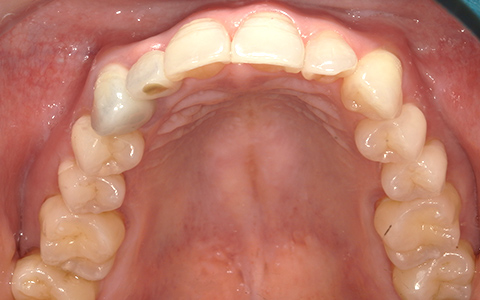 After image