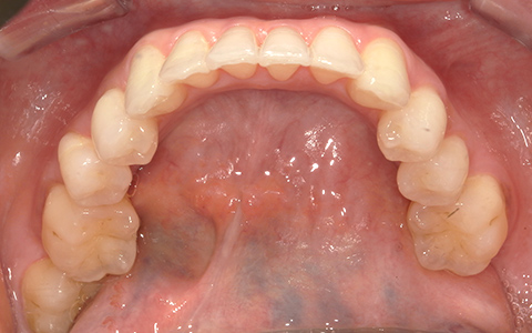 After image