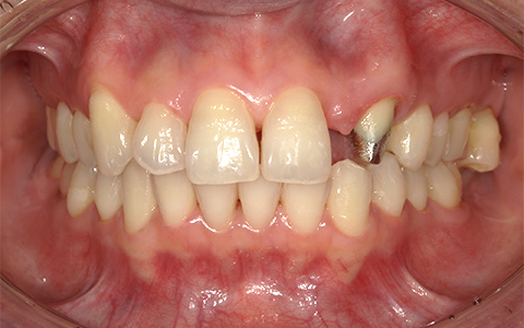 Before image