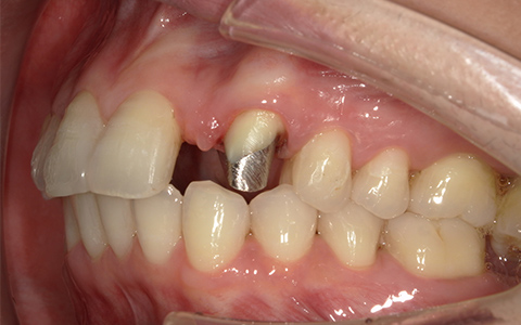 Before image
