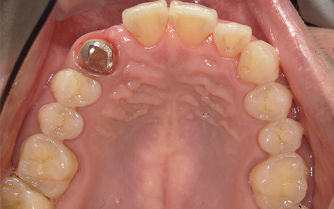 Before image