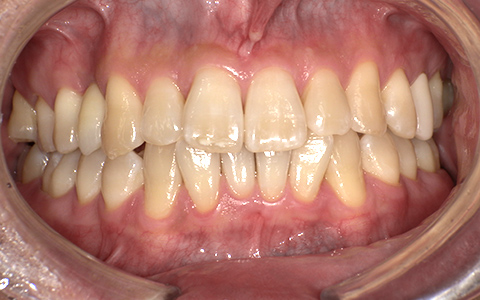 After image
