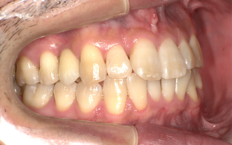 After image
