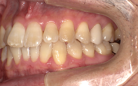 After image
