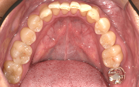 After image