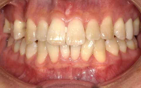 Before image