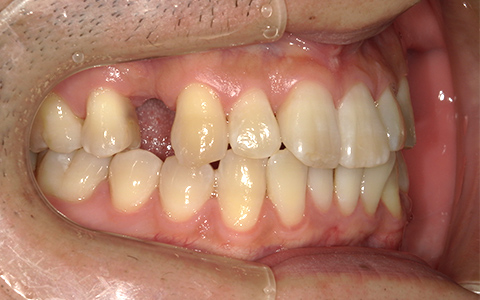 Before image