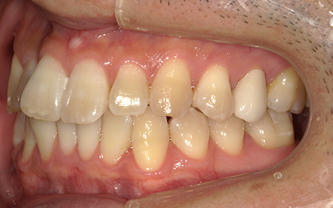 Before image