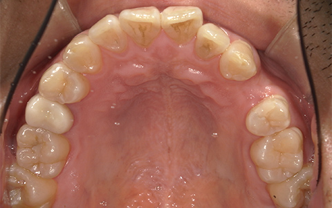 Before image