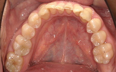 Before image