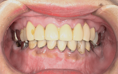 Before image