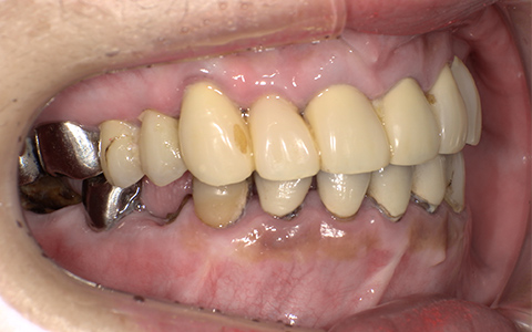 Before image