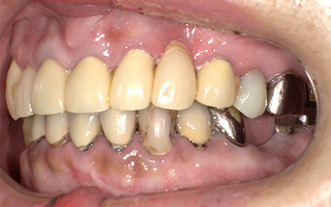 Before image