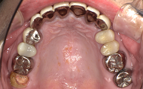 Before image