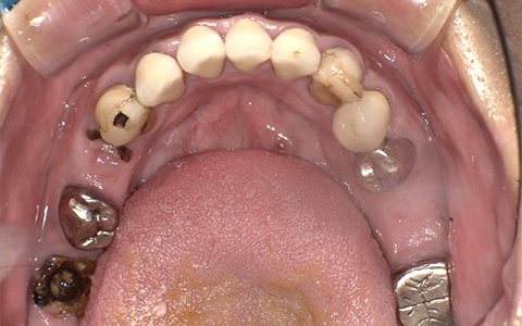 Before image
