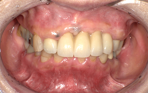 After image