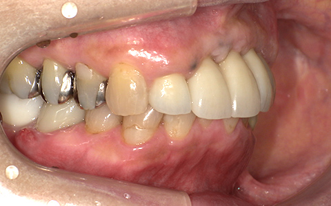 After image