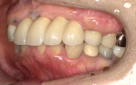 After image