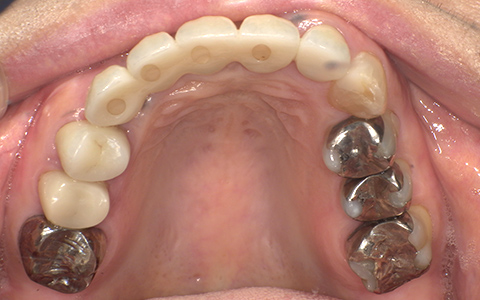 After image