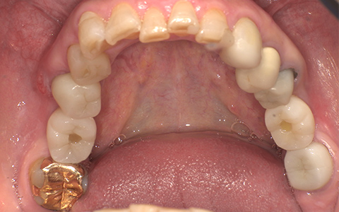 After image
