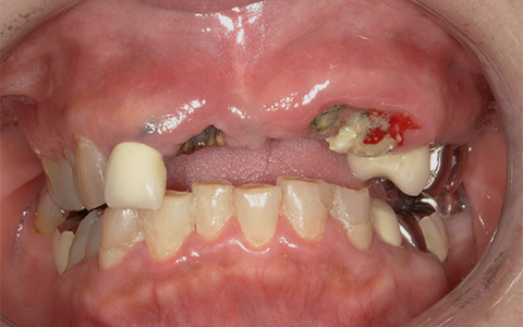 Before image