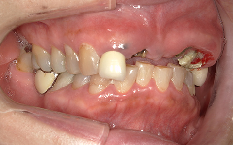 Before image