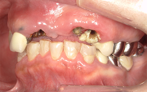 Before image