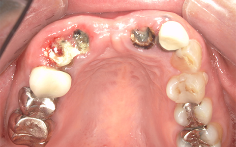 Before image
