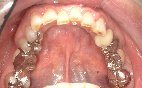 Before image