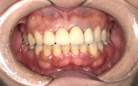 After image