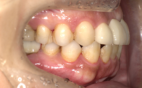 After image