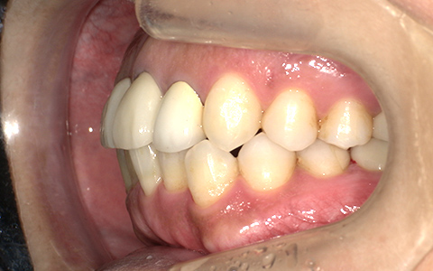 After image