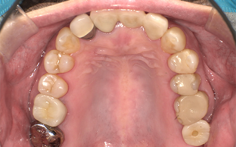 After image