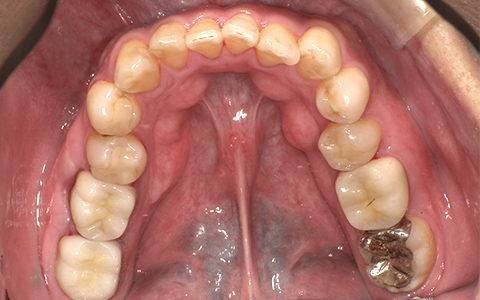 After image