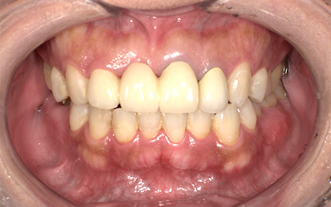 Before image