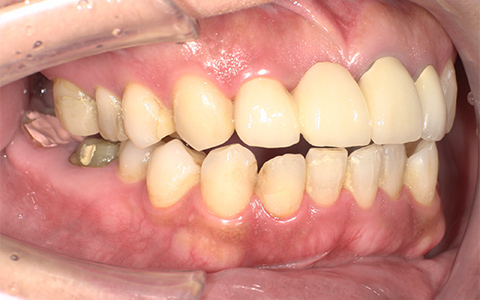 Before image
