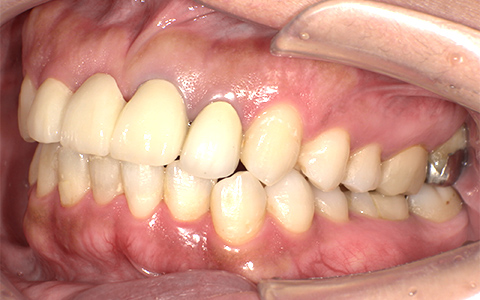 Before image