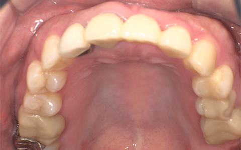 Before image