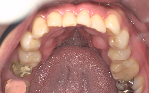 Before image