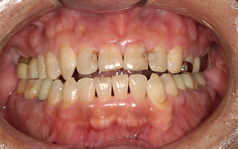 After image