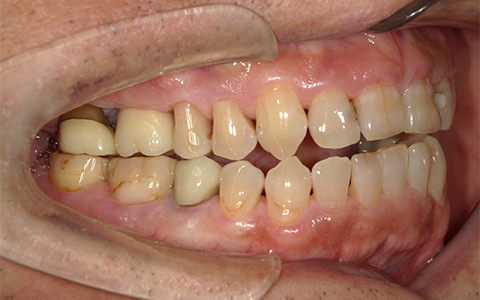 After image