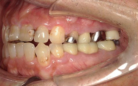 After image