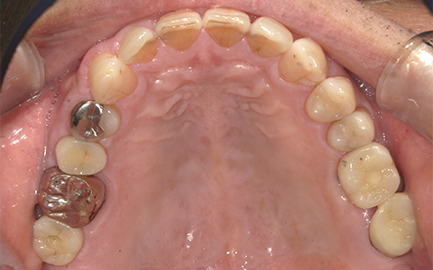 After image