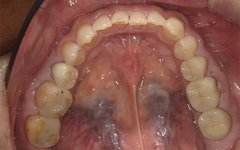 After image