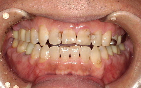 Before image
