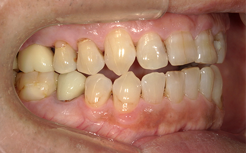 Before image