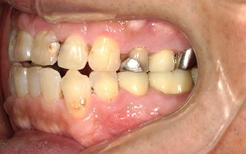 Before image
