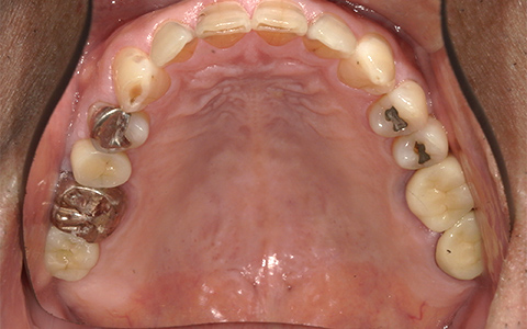 Before image