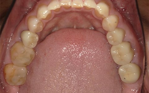 Before image